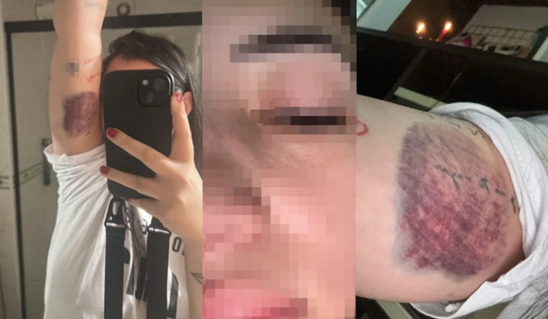 Passageira espancada em carro por app é ameaçada por mensagens